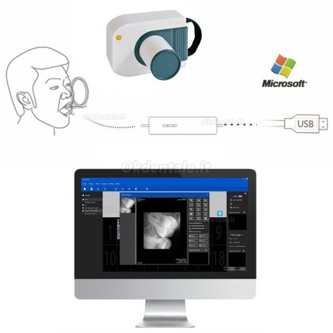 Dental Digital Image RVG X-Ray Sensor Dental Intraoral Imaging System